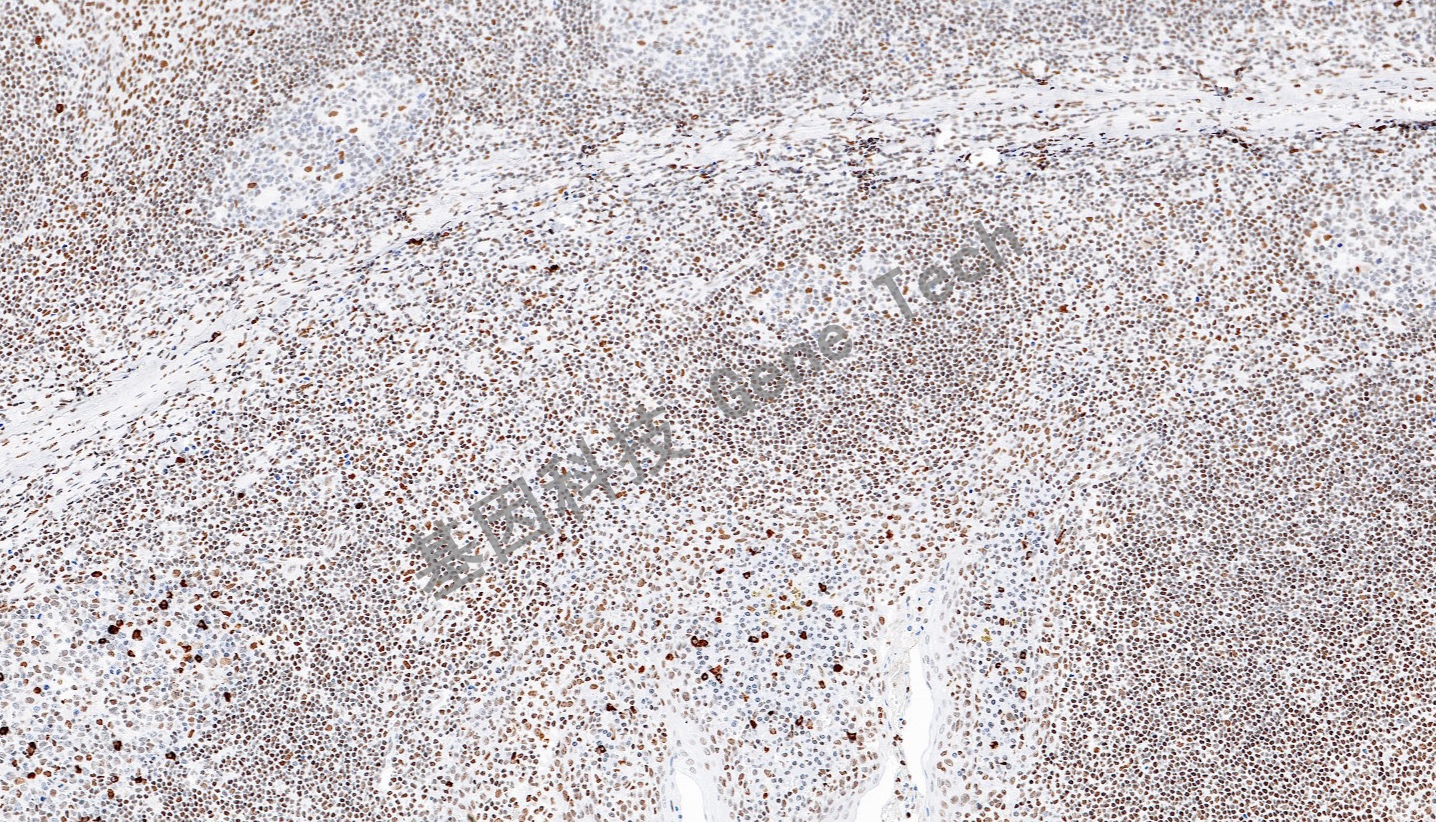 1691144058122844.jpg 1691144058122844.jpg